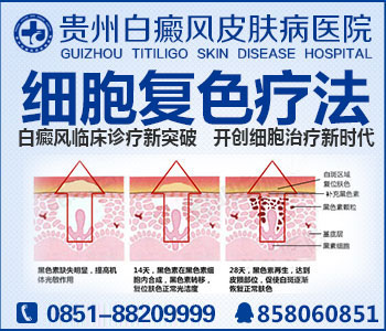 贵州治疗白癜风有哪些医院